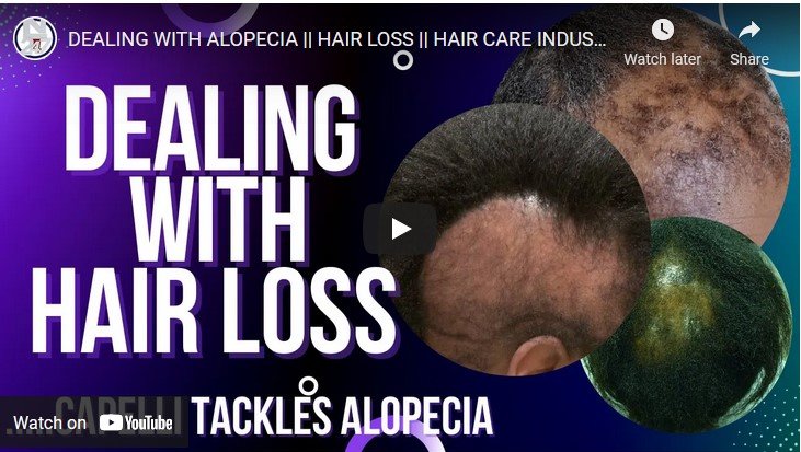 Dealing With Alopecia | Hair Loss || Hair Care Industry || Spotlight Nigeria